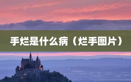 手烂是什么病（烂手图片）