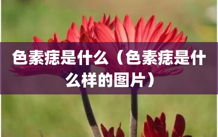 色素痣是什么（色素痣是什么样的图片）