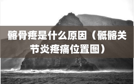 髂骨疼是什么原因（骶髂关节炎疼痛位置图）