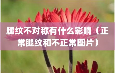 腿纹不对称有什么影响（正常腿纹和不正常图片）