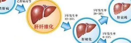 肝脏代谢功能（肝脏代谢功能差的症状）