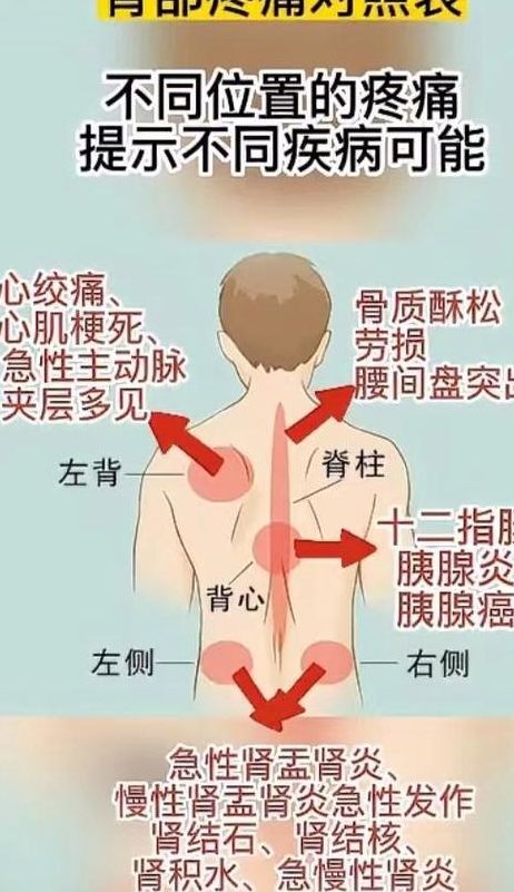 背后左肩胛骨疼痛对照表图（后背左肩胛骨疼痛怎么治疗）